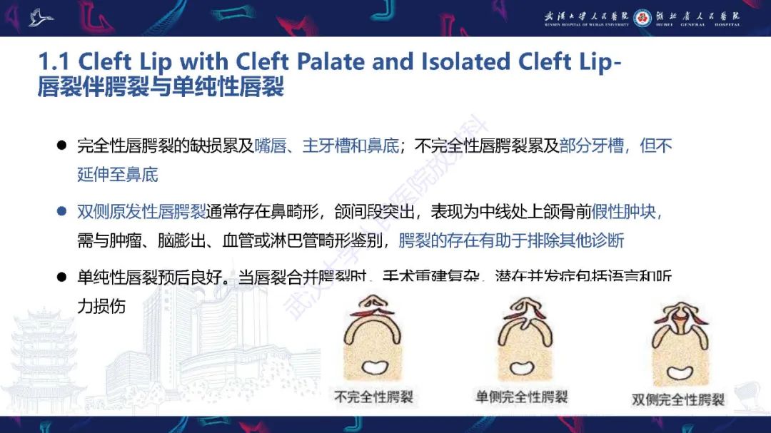 影像PPT - 【PPT】胎儿面部畸形MR诊断-18