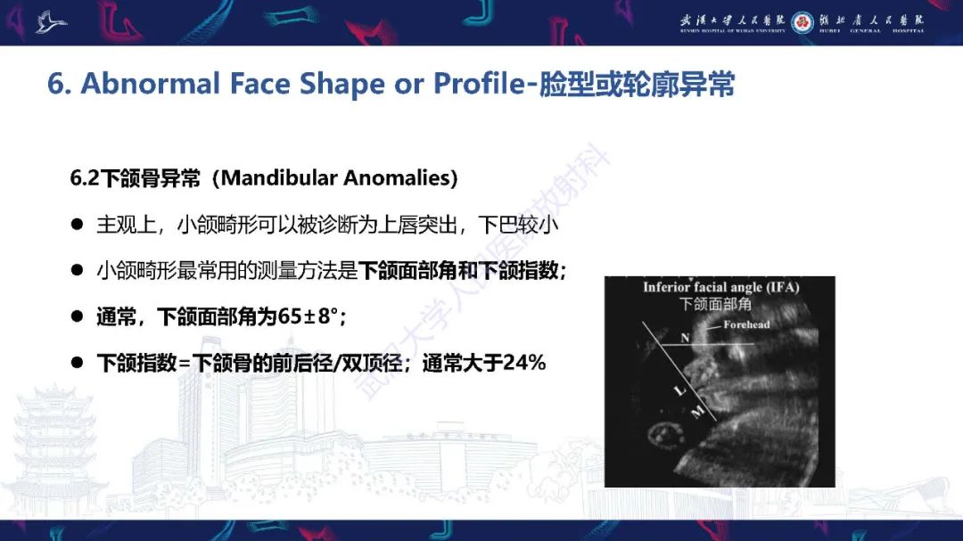 影像PPT - 【PPT】胎儿面部畸形MR诊断-51