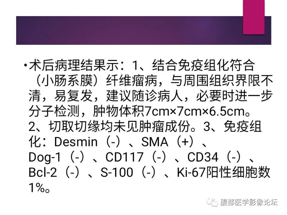 影像PPT - 【病例】肠系膜纤维瘤病1例CT影像-20
