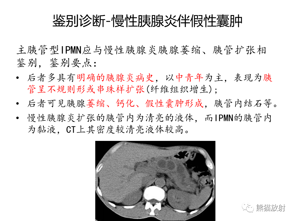 影像PPT - 【病例】慢性胰腺炎VS胰腺导管内乳头状黏液性肿瘤-39