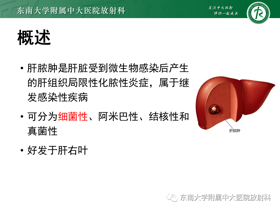 影像PPT - 【病例】细菌性肝脓肿1例CT影像-4