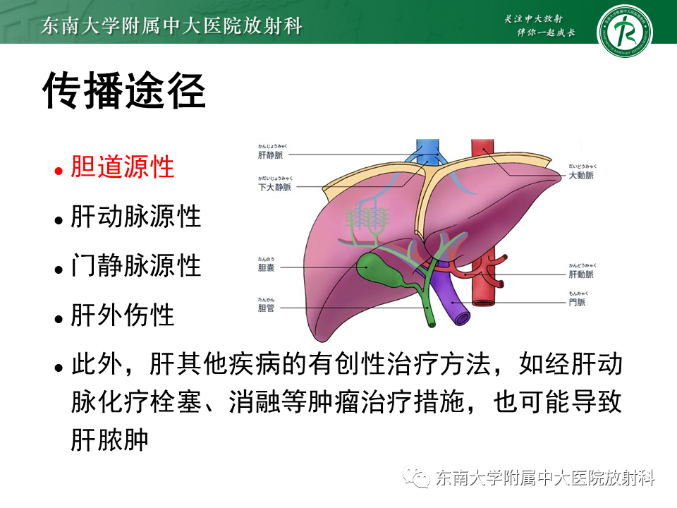 影像PPT - 【病例】细菌性肝脓肿1例CT影像-6