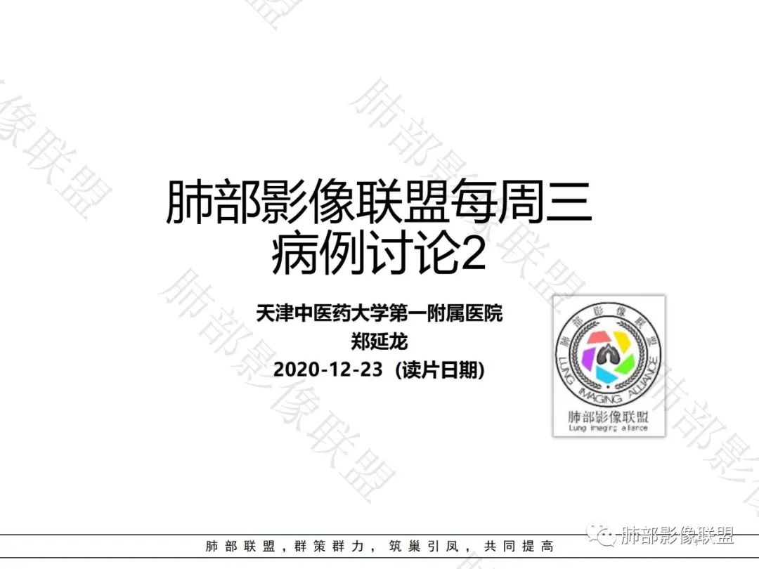 影像PPT - 【病例】淋巴瘤肺浸润1例CT影像讨论-1 影像PPT - 【病例】淋巴瘤肺浸润1例CT影像讨论-1