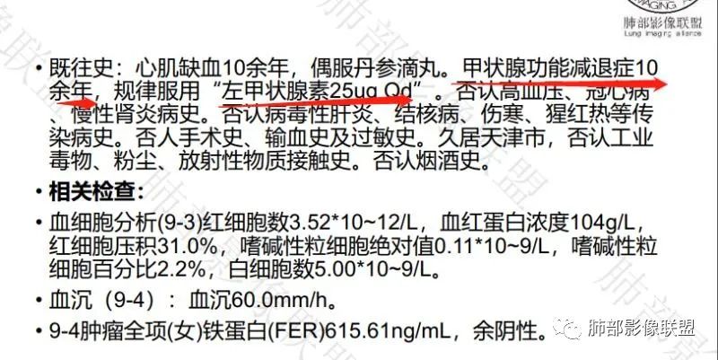 影像PPT - 【病例】淋巴瘤肺浸润1例CT影像讨论-15 影像PPT - 【病例】淋巴瘤肺浸润1例CT影像讨论-15