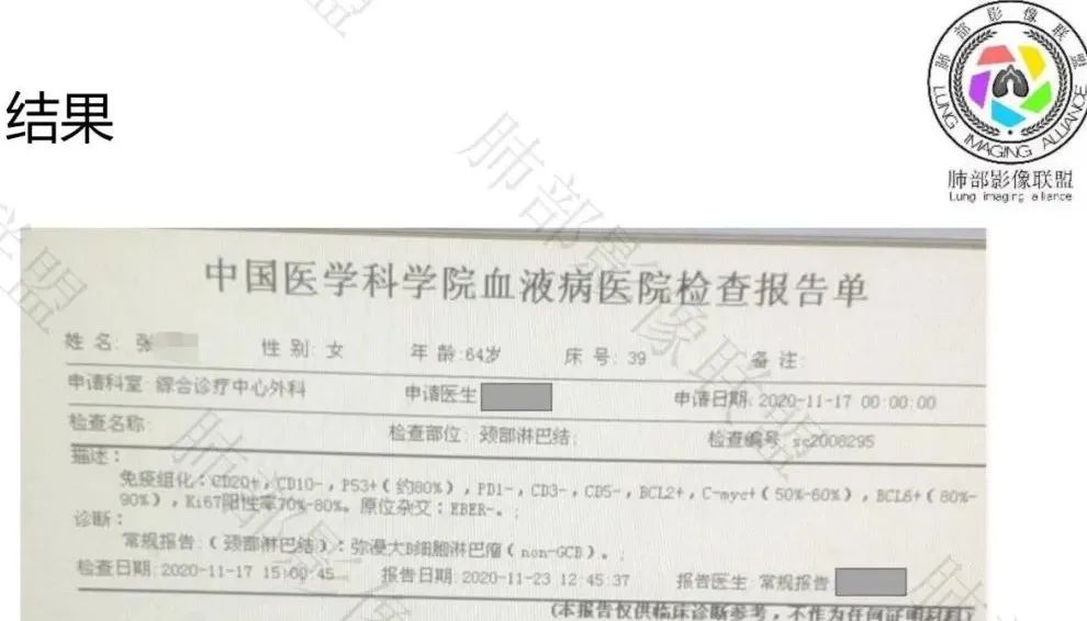影像PPT - 【病例】淋巴瘤肺浸润1例CT影像讨论-23 影像PPT - 【病例】淋巴瘤肺浸润1例CT影像讨论-23