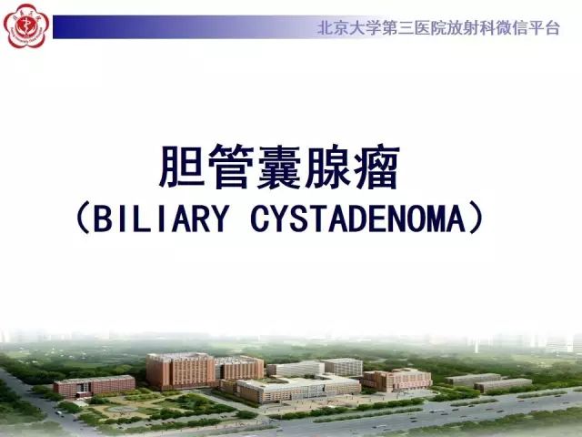 影像PPT - 【病例】胆管囊腺瘤1例CT及MR影像-17