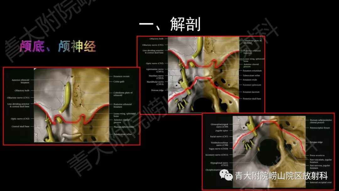 影像PPT - 【PPT】头颈部影像检查报告规范-4