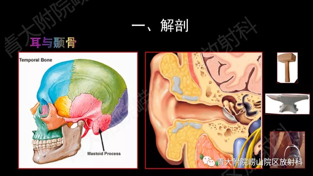 影像PPT - 【PPT】头颈部影像检查报告规范-5