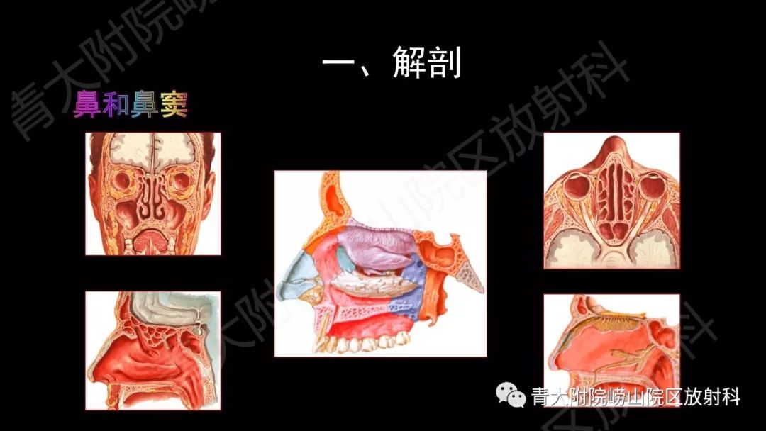 影像PPT - 【PPT】头颈部影像检查报告规范-7