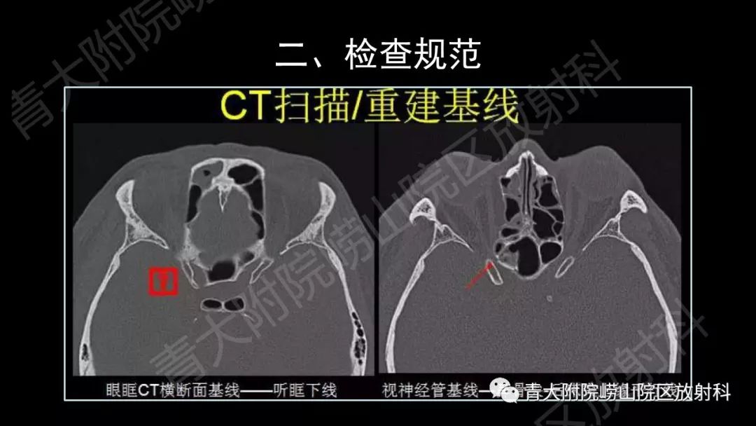 影像PPT - 【PPT】头颈部影像检查报告规范-13