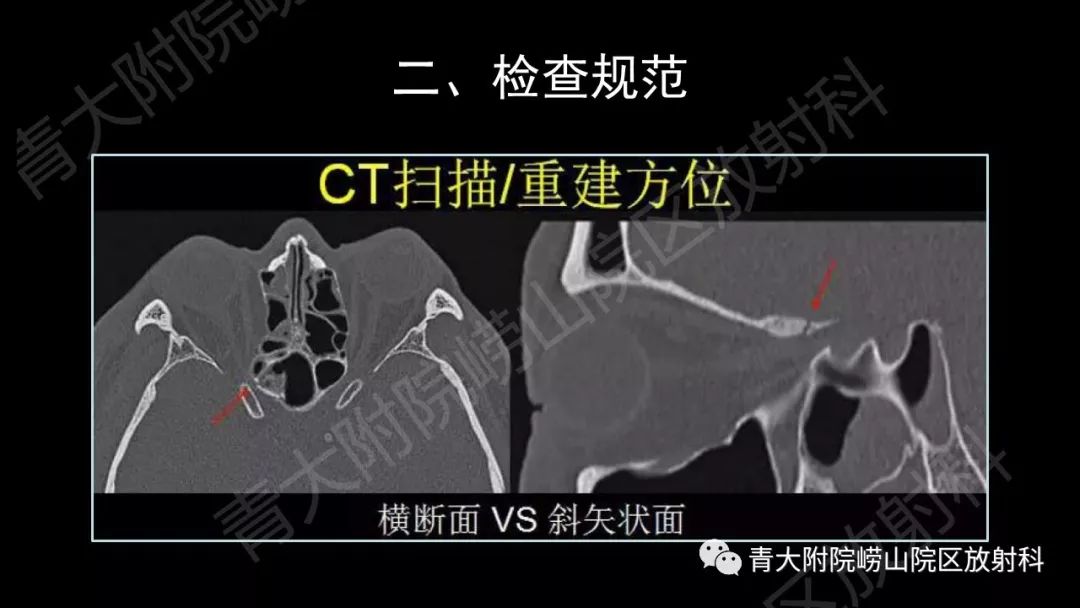 影像PPT - 【PPT】头颈部影像检查报告规范-14