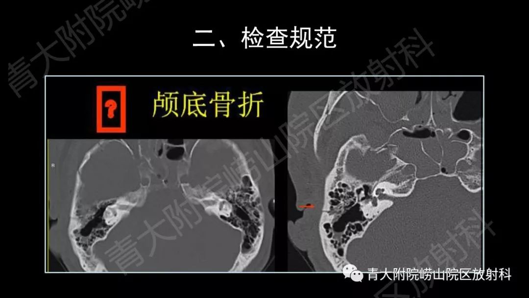 影像PPT - 【PPT】头颈部影像检查报告规范-17