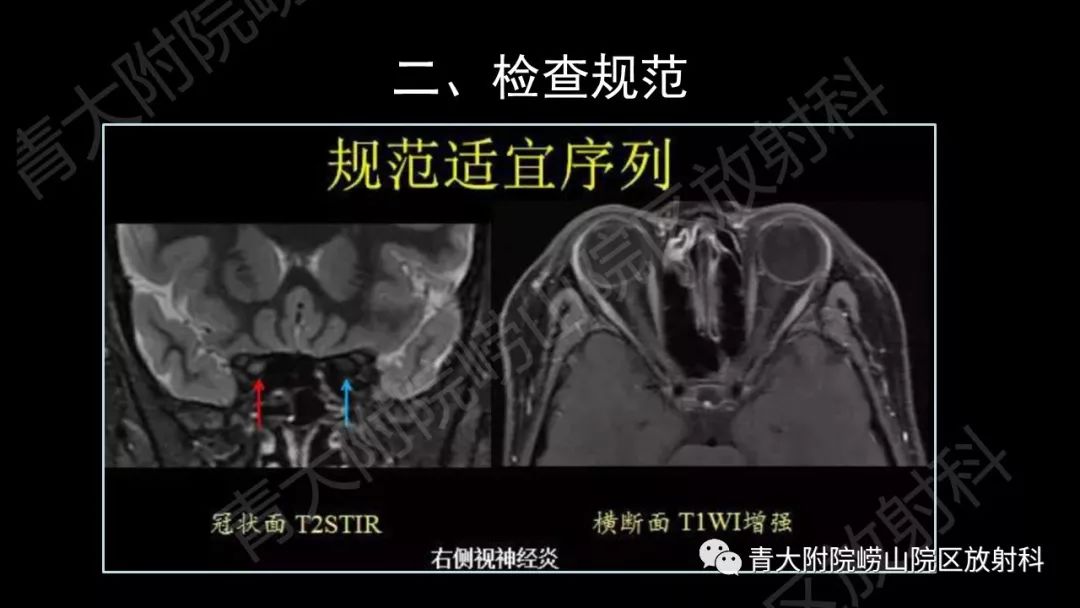 影像PPT - 【PPT】头颈部影像检查报告规范-18