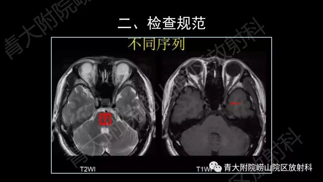 影像PPT - 【PPT】头颈部影像检查报告规范-19