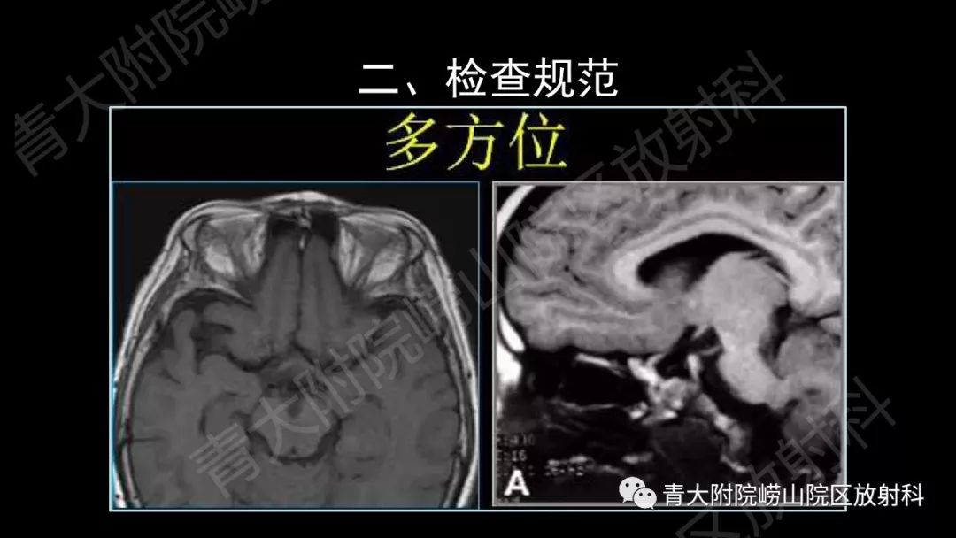 影像PPT - 【PPT】头颈部影像检查报告规范-20