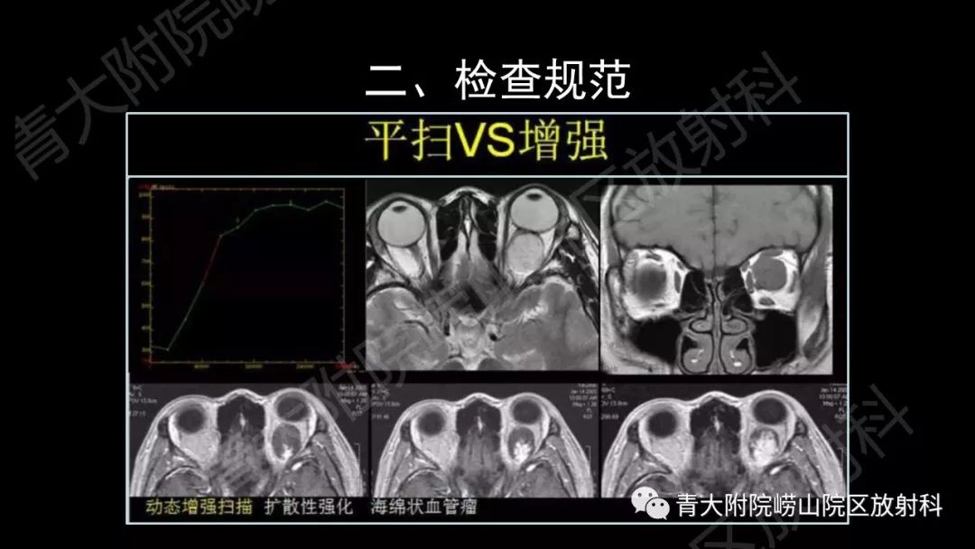 影像PPT - 【PPT】头颈部影像检查报告规范-21