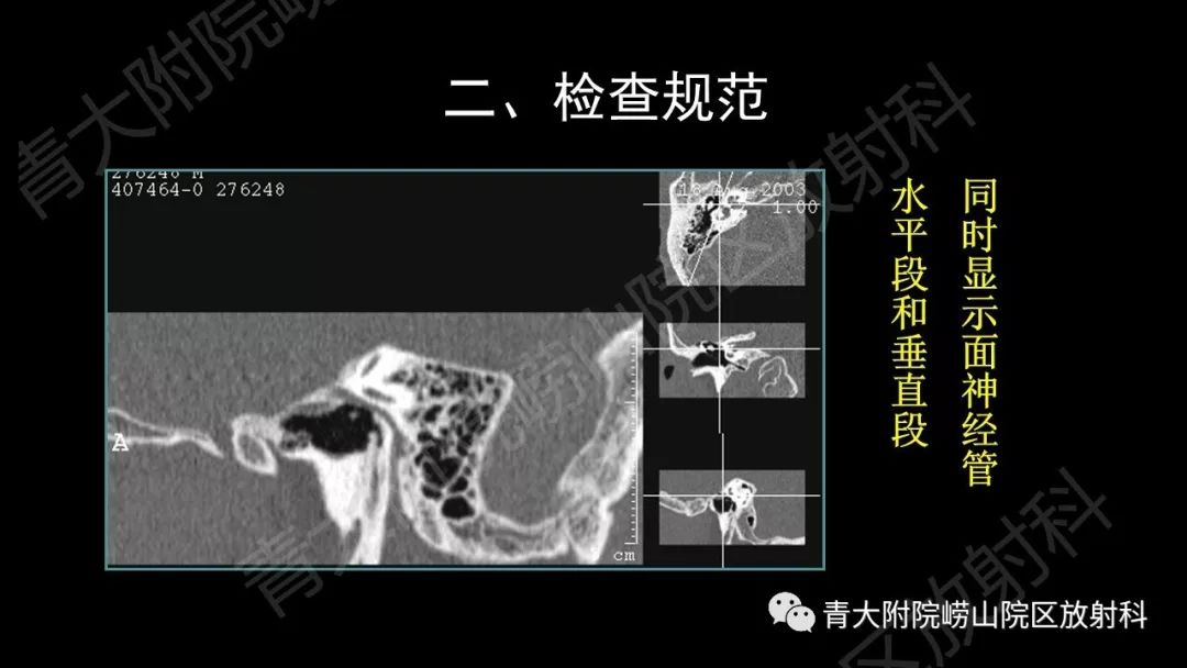 影像PPT - 【PPT】头颈部影像检查报告规范-22