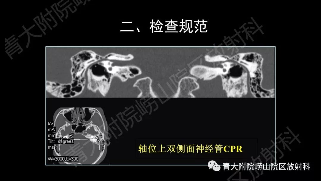 影像PPT - 【PPT】头颈部影像检查报告规范-23