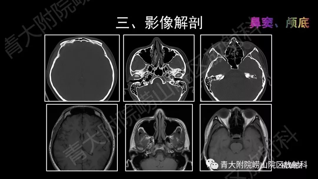 影像PPT - 【PPT】头颈部影像检查报告规范-24