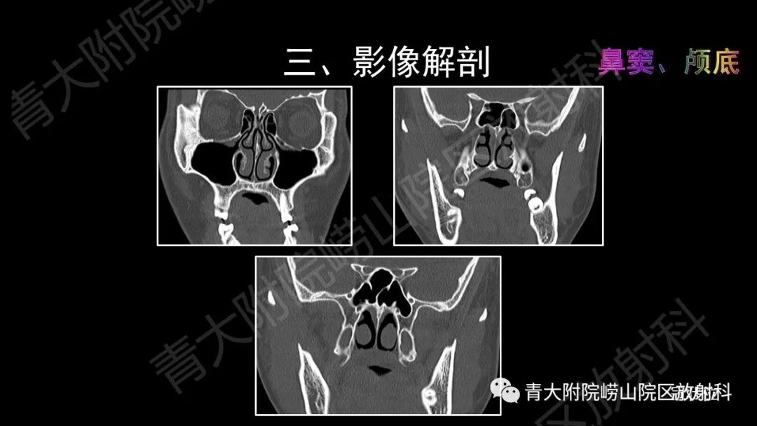 影像PPT - 【PPT】头颈部影像检查报告规范-25