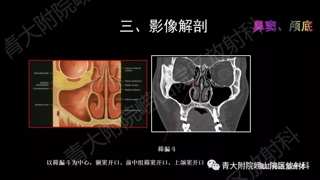 影像PPT - 【PPT】头颈部影像检查报告规范-26