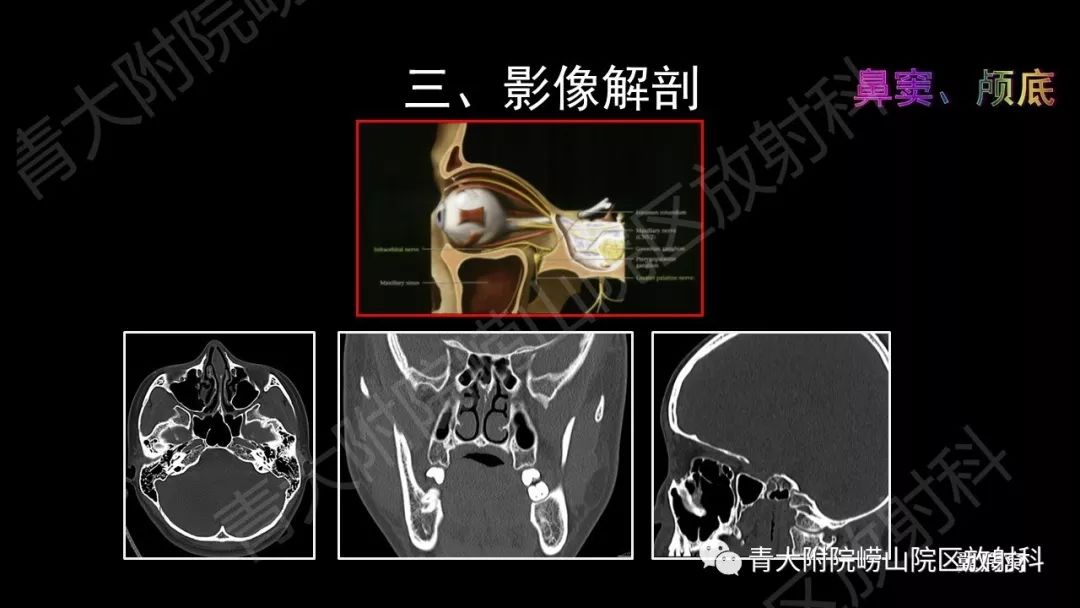 影像PPT - 【PPT】头颈部影像检查报告规范-27