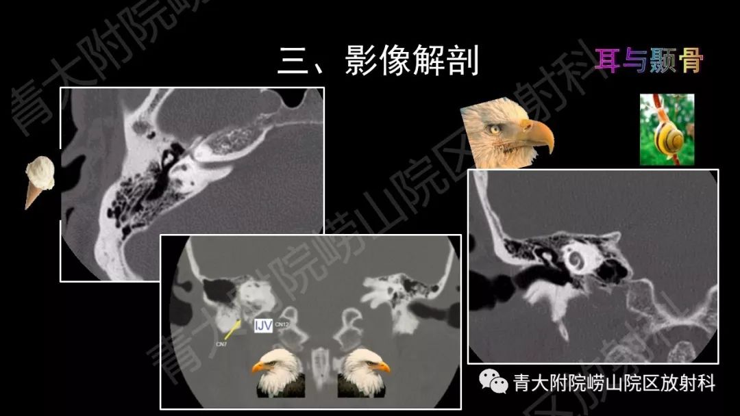 影像PPT - 【PPT】头颈部影像检查报告规范-28