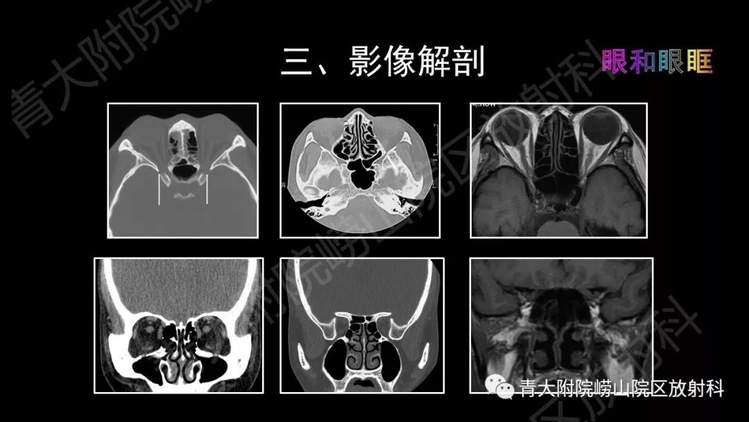 影像PPT - 【PPT】头颈部影像检查报告规范-29