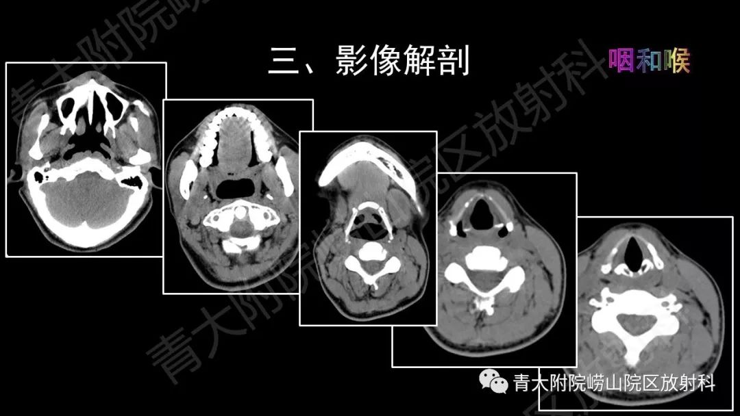 影像PPT - 【PPT】头颈部影像检查报告规范-30