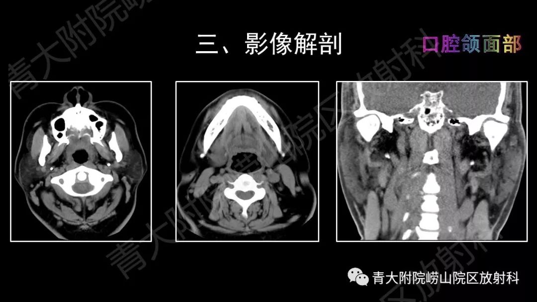影像PPT - 【PPT】头颈部影像检查报告规范-31