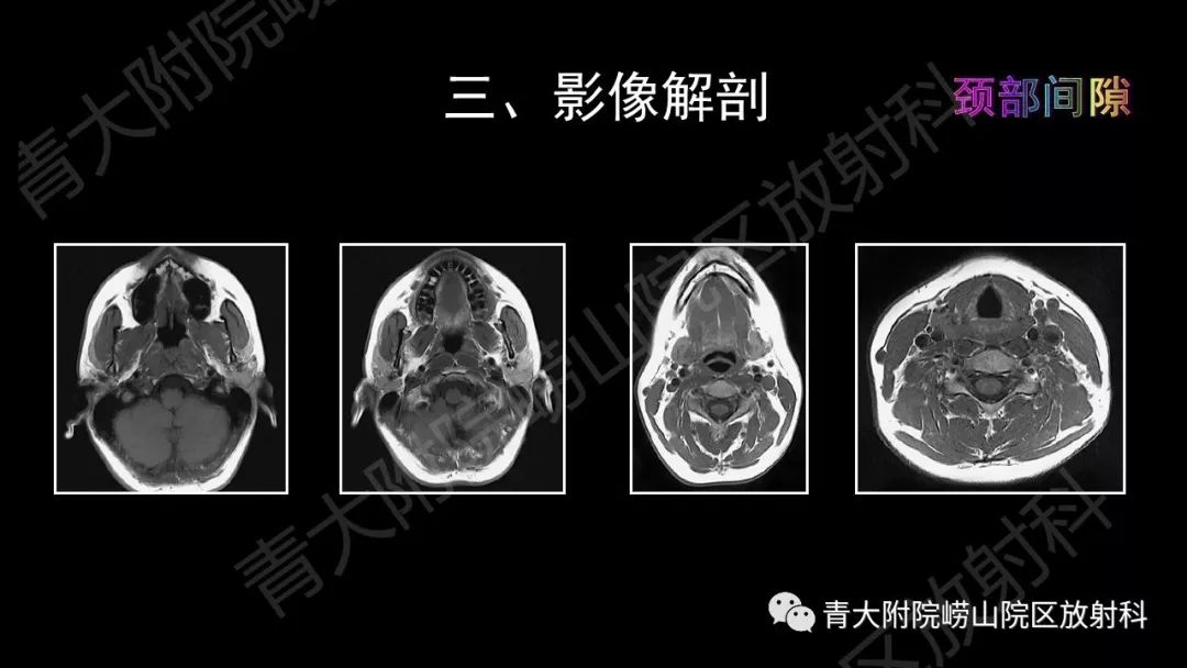 影像PPT - 【PPT】头颈部影像检查报告规范-32