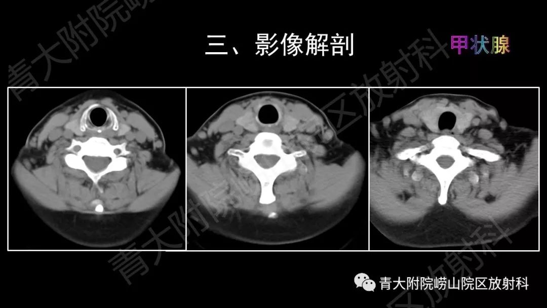 影像PPT - 【PPT】头颈部影像检查报告规范-33