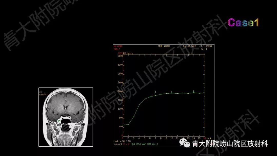 影像PPT - 【PPT】头颈部影像检查报告规范-54