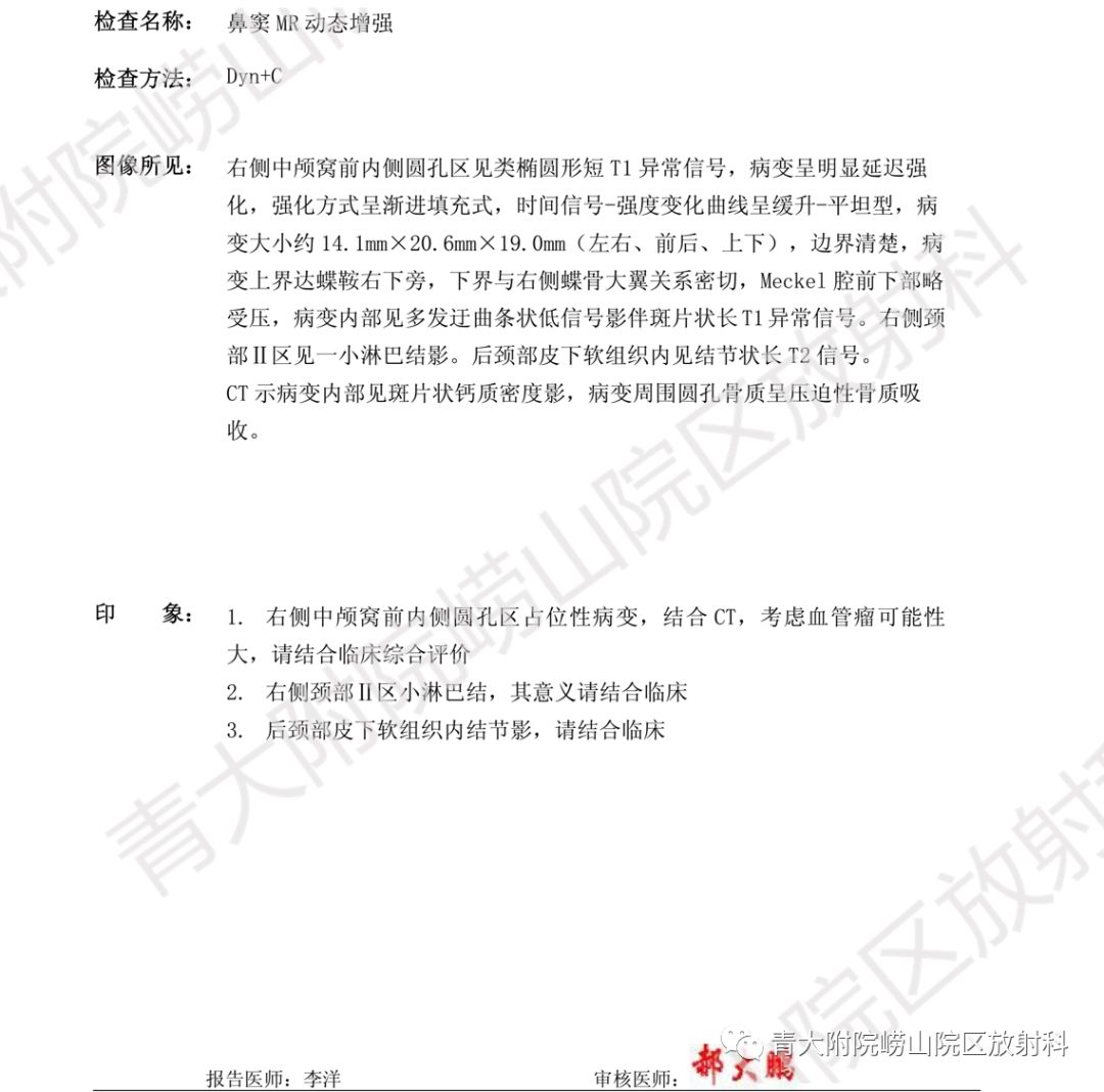 影像PPT - 【PPT】头颈部影像检查报告规范-55