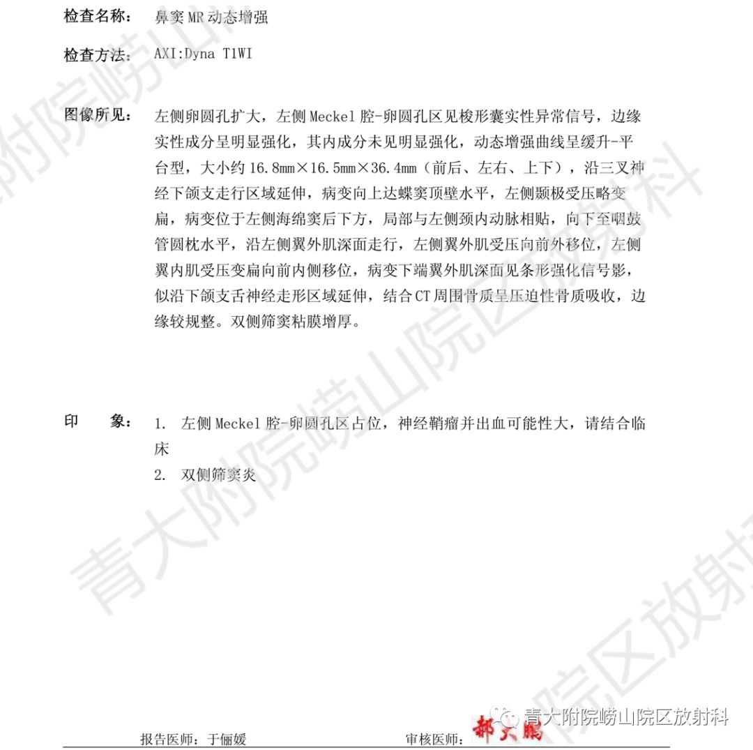 影像PPT - 【PPT】头颈部影像检查报告规范-60