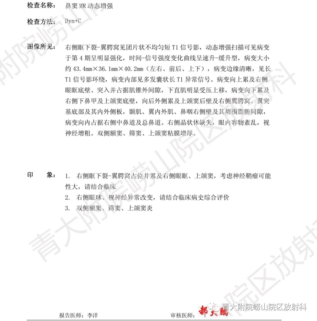 影像PPT - 【PPT】头颈部影像检查报告规范-64