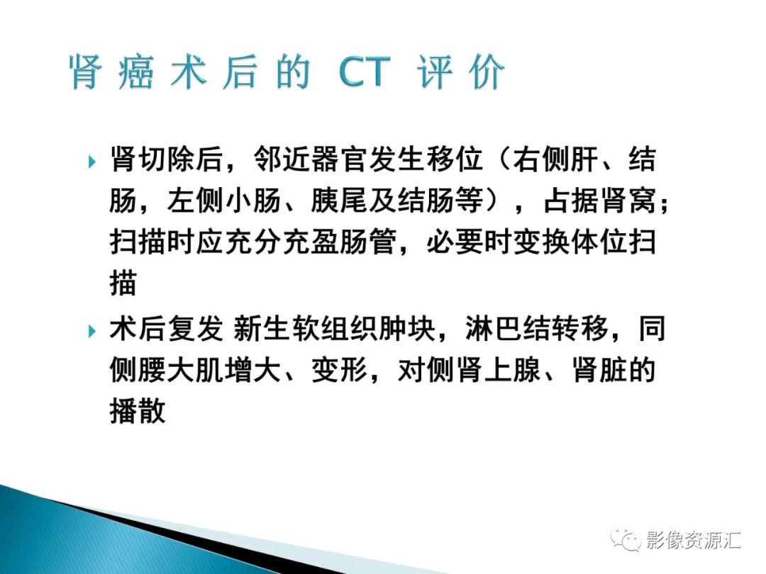 影像PPT - 【PPT】肾癌的CT MRI诊断-44