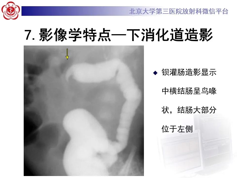 影像PPT - 【病例】肠旋转不良IM的影像-20