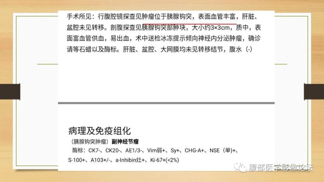 影像PPT - 【病例】胰腺副神经节瘤1例CT及MR影像-8