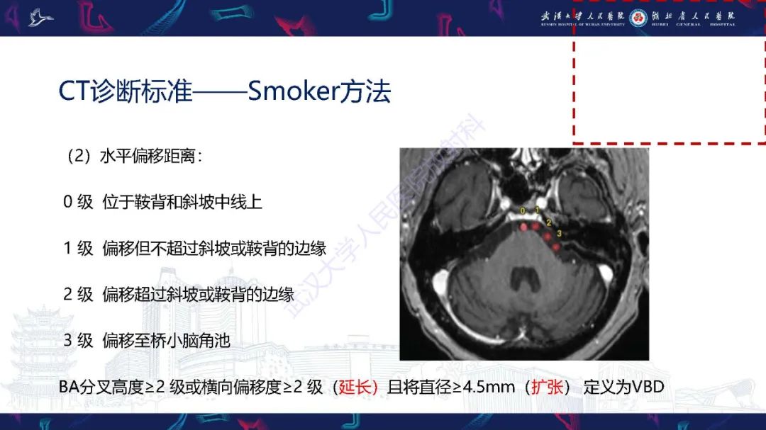 影像PPT - 【PPT】椎基底动脉扩张延长症影像诊断-8