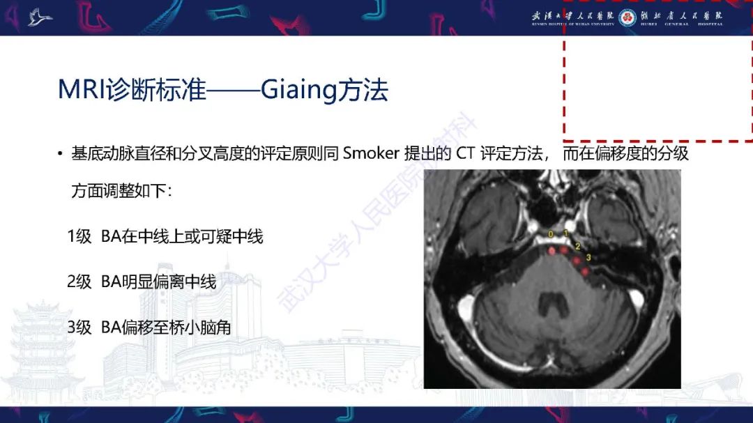 影像PPT - 【PPT】椎基底动脉扩张延长症影像诊断-9