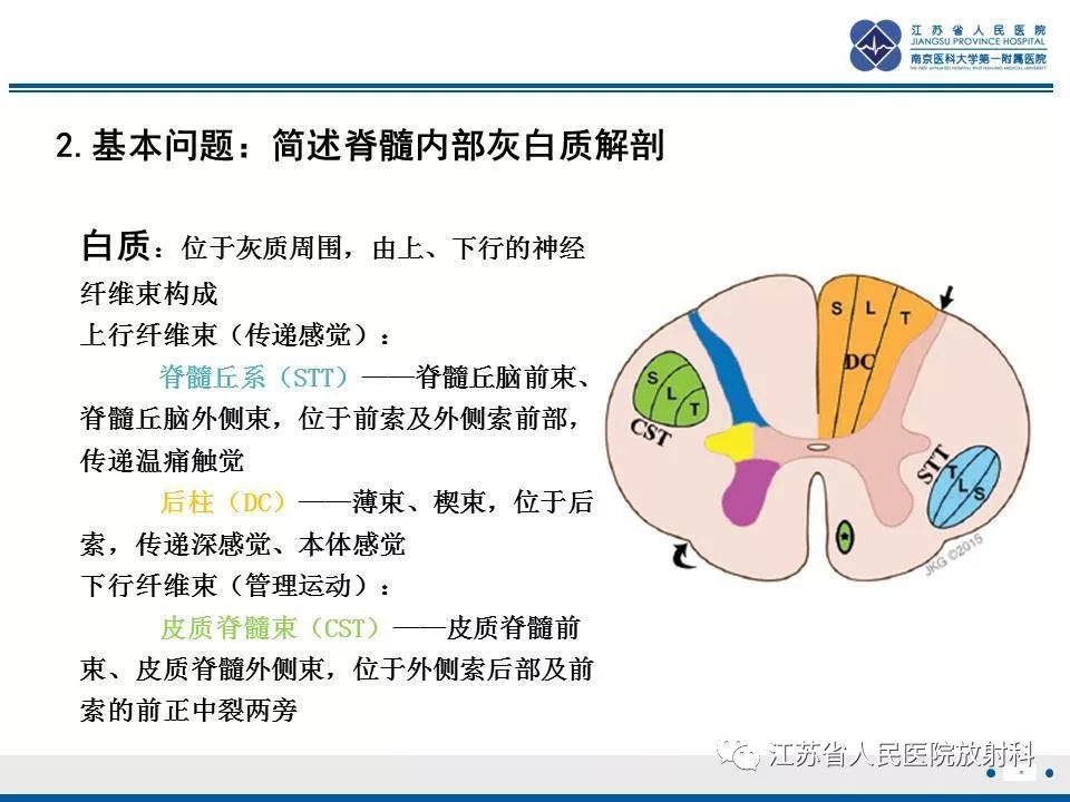 影像PPT - 【病例】脊髓梗死—脊髓前动脉综合征1例MR-10