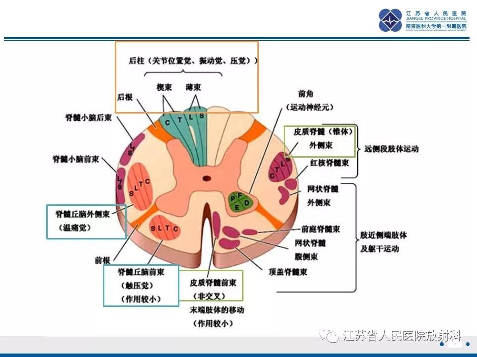 影像PPT - 【病例】脊髓梗死—脊髓前动脉综合征1例MR-11