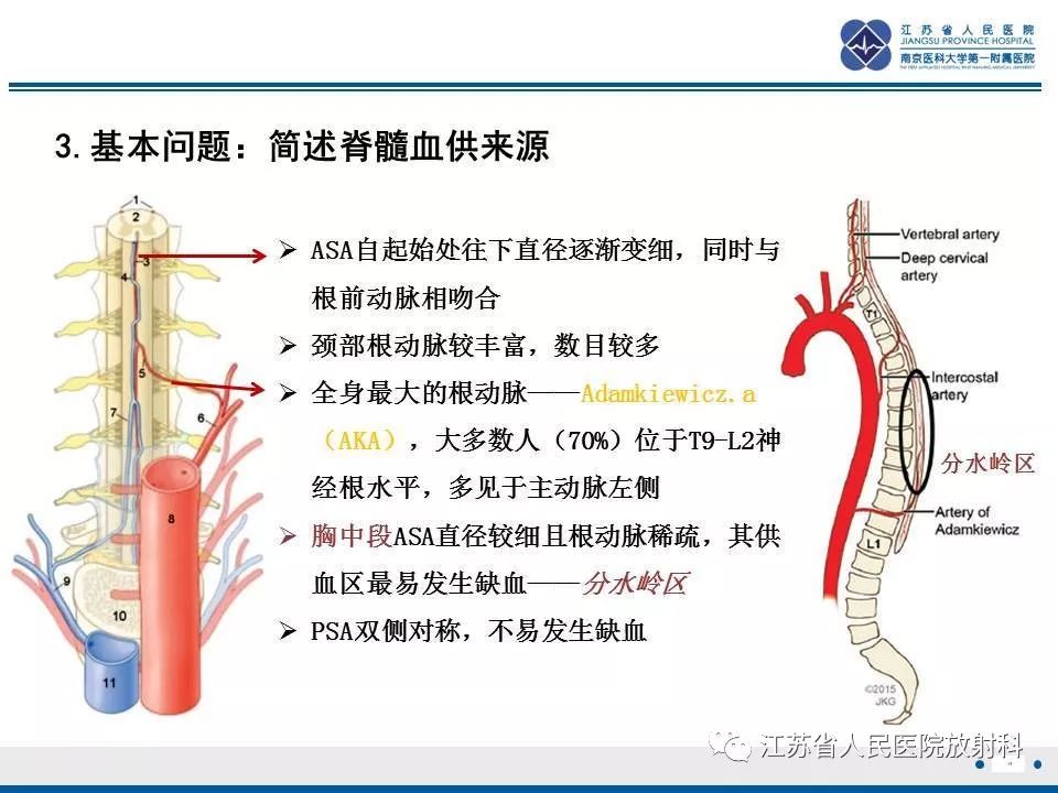 影像PPT - 【病例】脊髓梗死—脊髓前动脉综合征1例MR-14