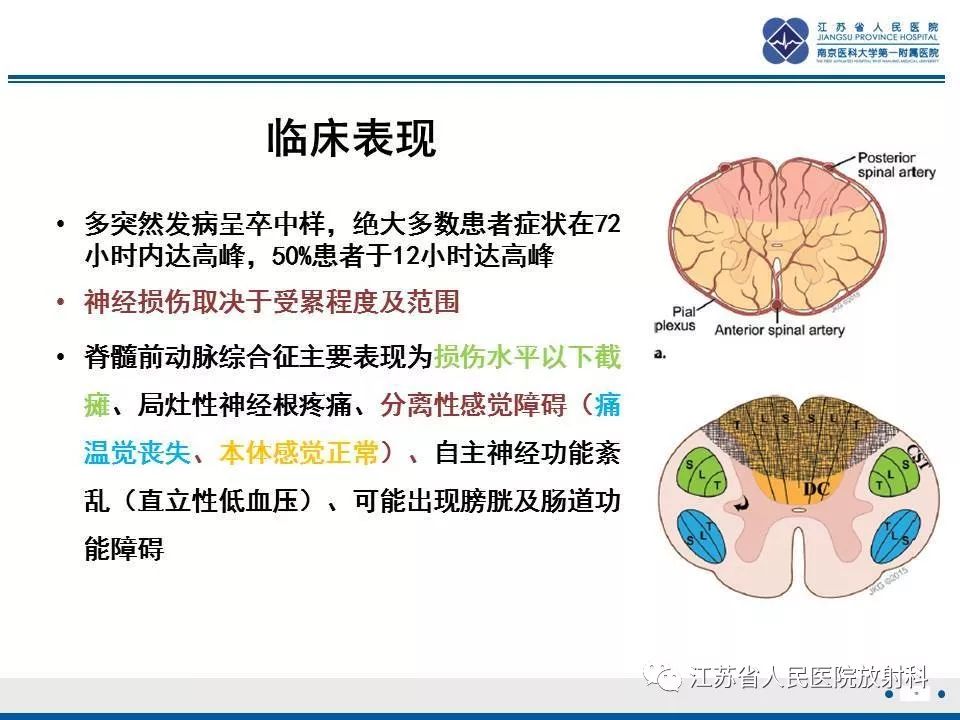 影像PPT - 【病例】脊髓梗死—脊髓前动脉综合征1例MR-19