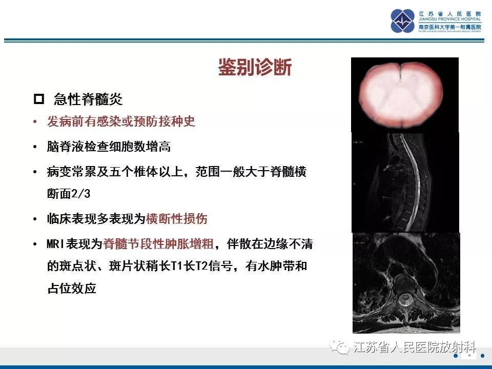 影像PPT - 【病例】脊髓梗死—脊髓前动脉综合征1例MR-23
