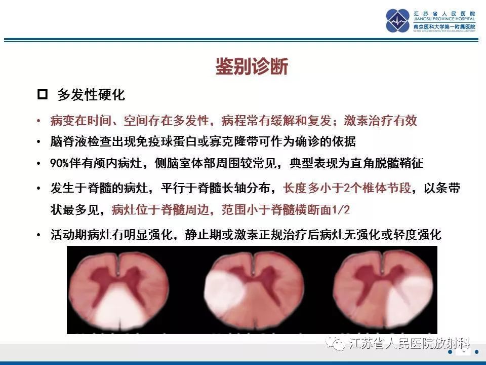 影像PPT - 【病例】脊髓梗死—脊髓前动脉综合征1例MR-24