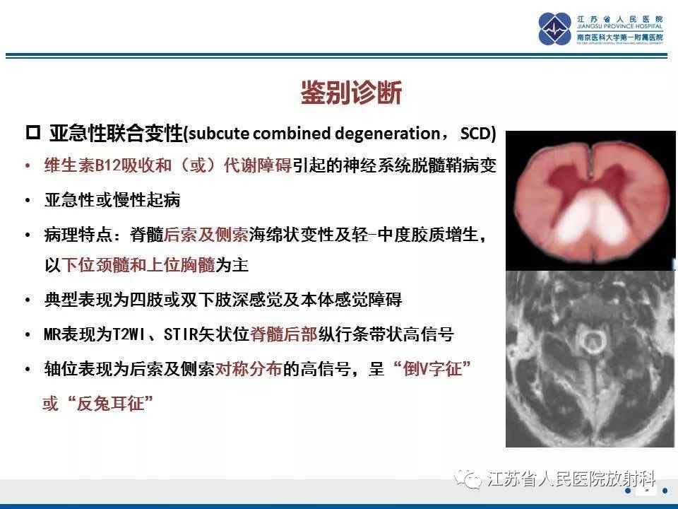 影像PPT - 【病例】脊髓梗死—脊髓前动脉综合征1例MR-26