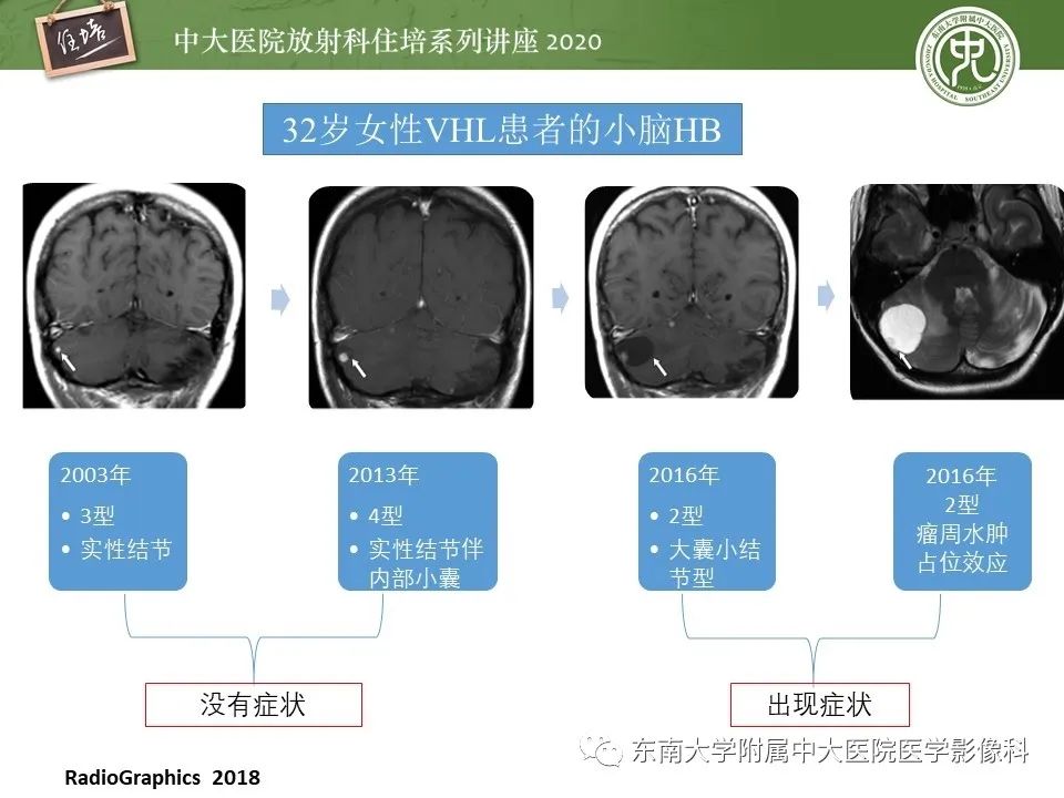 影像PPT - 【PPT】小脑占位的影像分析思路-13