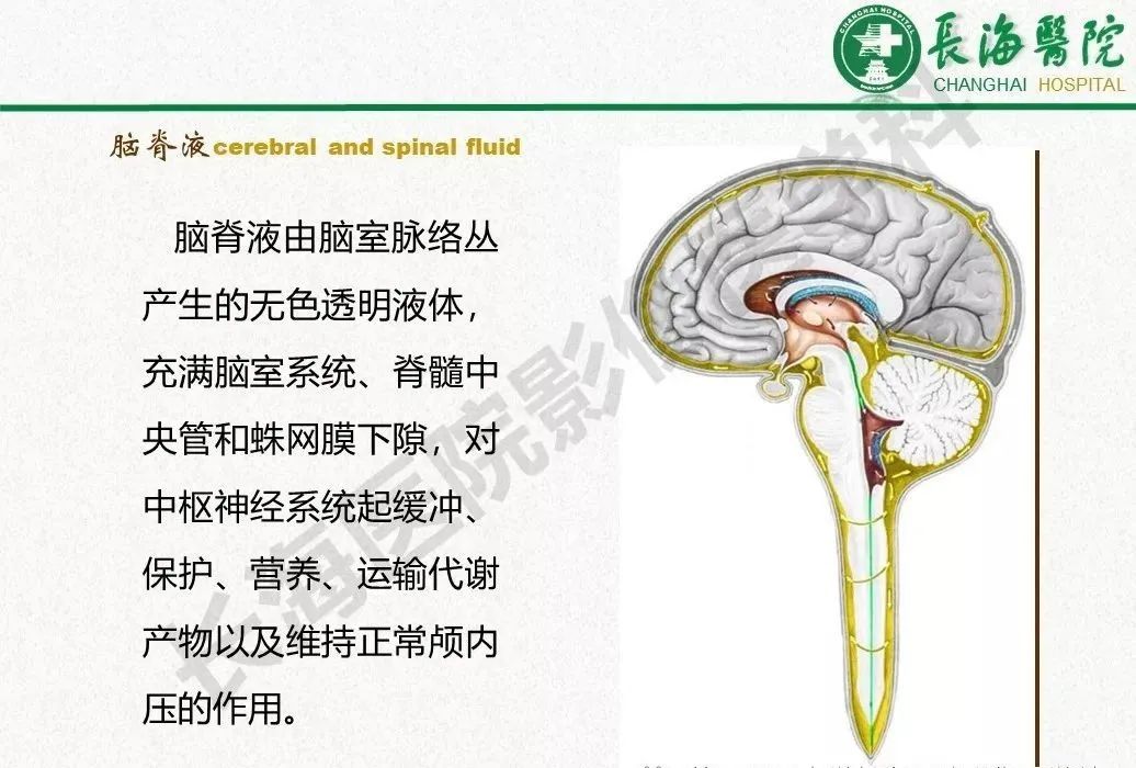 影像PPT - 【PPT】低颅压综合征-5